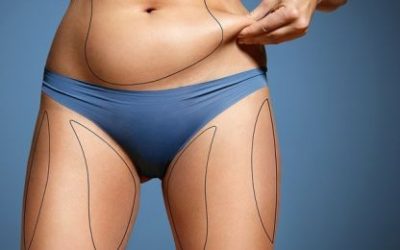 Kako zavoljeti nevoljene dijelove tijela?