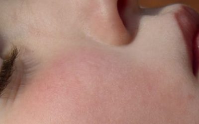 Kako zaustaviti štucanje