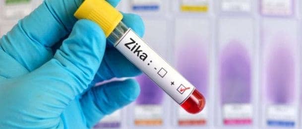 Virus Zika prijeti svijetu